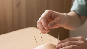 鍼灸師が患部に施術する姿。手元のクローズアップ。