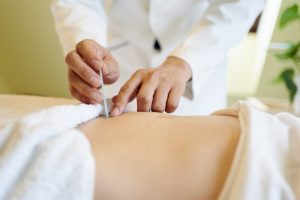 過敏性腸症候群の改善を目指す鍼灸整体院での治療